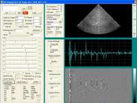  * ATS539 image reconstructed with data acquired with the high frame rate ultrasound imaging system * 