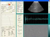  * ATS539 image reconstructed with data acquired with the high frame rate ultrasound imaging system * 