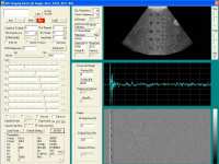 * ATS539 image reconstructed with data acquired with the high frame rate ultrasound imaging system * 