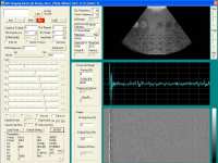  * ATS539 image reconstructed with data acquired with the high frame rate ultrasound imaging system * 