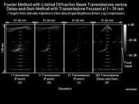  * Simulation with Limited-Diffraction Array Beams * 