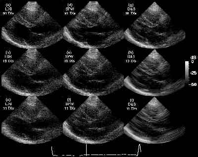  * Heart Images Reconstructed with Limited-Diffraction Array Beams with Square-Wave Aperture Weightings * 