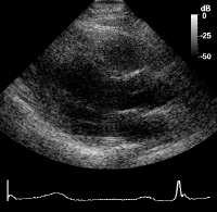  * Heart Image Reconstructed at 486 Frames/s with Fourier Method * 