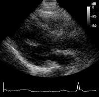  * Heart Image Reconstructed at 59 Frames/s with Fourier Method * 