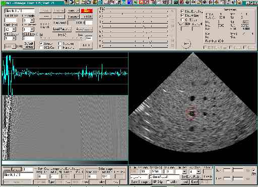  * ATS539 phatom image obtained with RF echo data with the IMT software * 