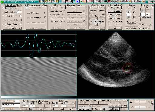  * Cine loop images reconstructed and displayed with the IRLAB software * 